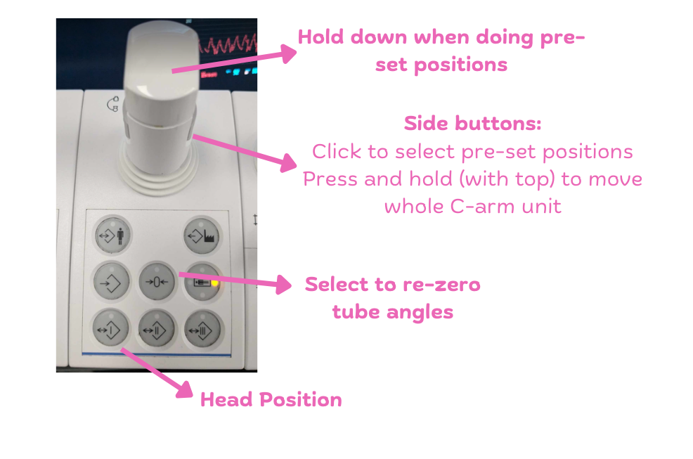 Table_controls_eq2